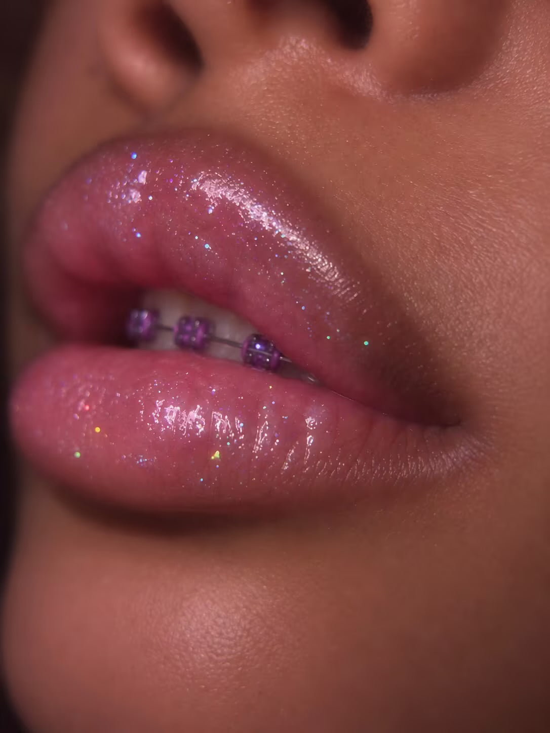 Beauty treats Glitter Lipgloss